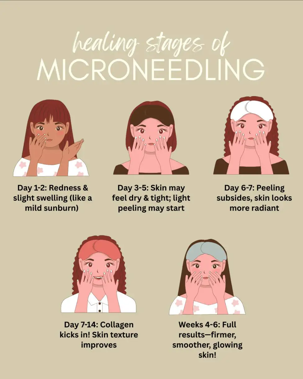 After Care stages of Micro needling process